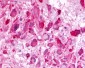 ADGRL3 / LPHN3 Antibody (C-Terminus)